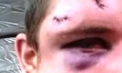 Violent and other Assault Victims